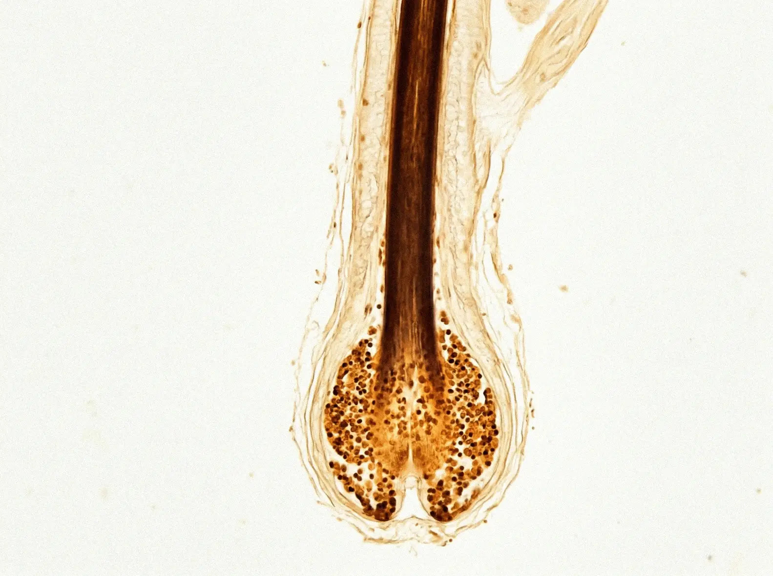 Terminal hair follicle, longitudinal section. Hair Labs imaging, 2025.